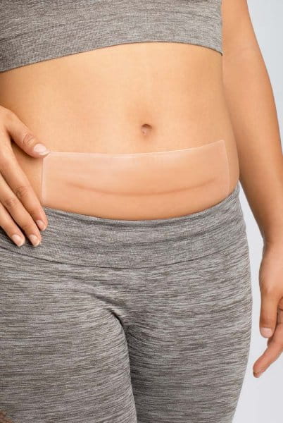 Amoena CuraScar Squares 011 aus Silikon zur Narbentherapie