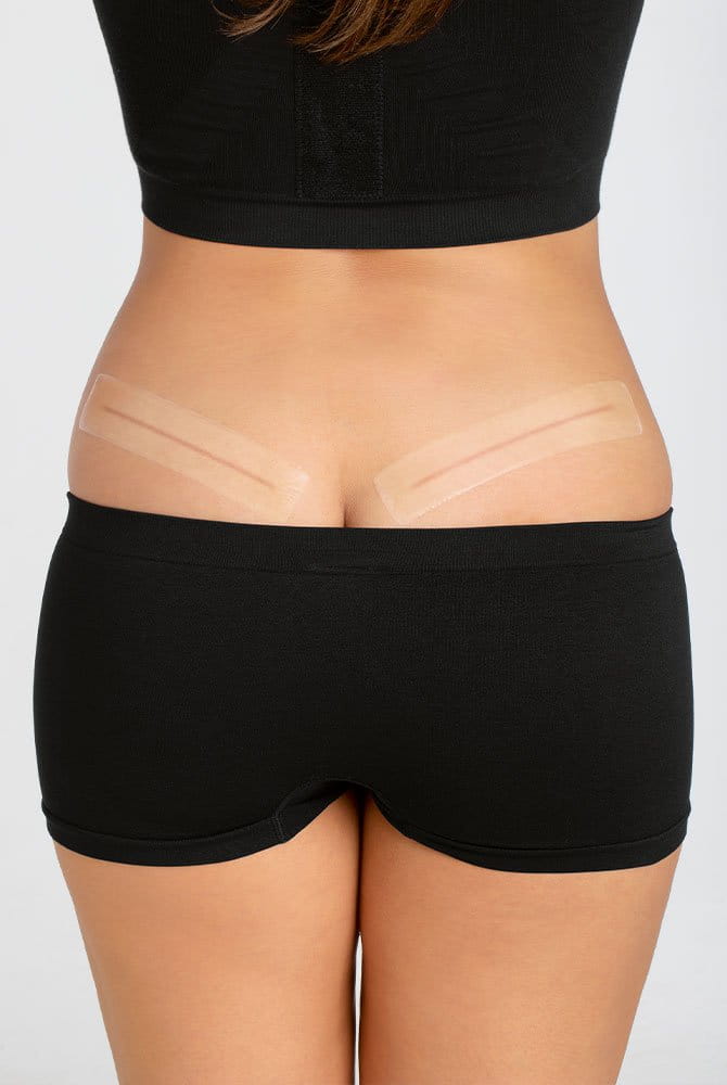 Amoena CuraScar Strips 010 aus Silikon zur Narbentherapie